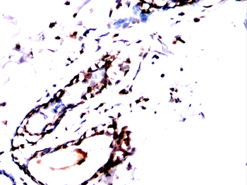 AKT Antibody