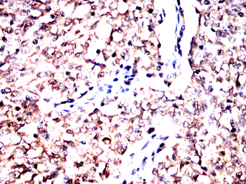 AKT Antibody