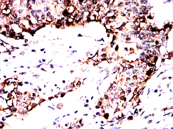 AKT Antibody