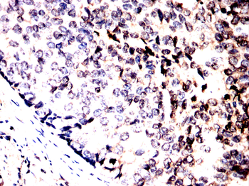 AKT Antibody