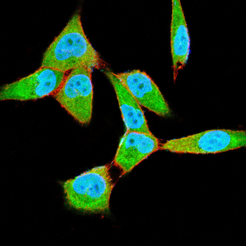 AKT Antibody