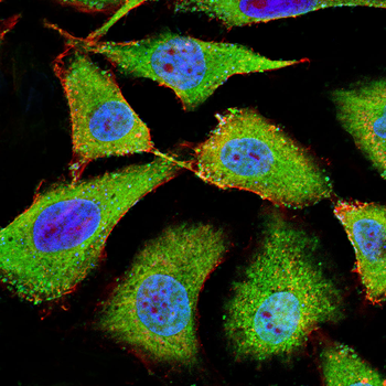 TFF2 Antibody