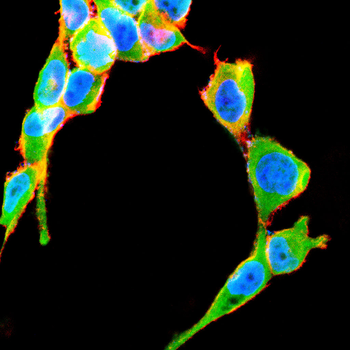 TFF2 Antibody