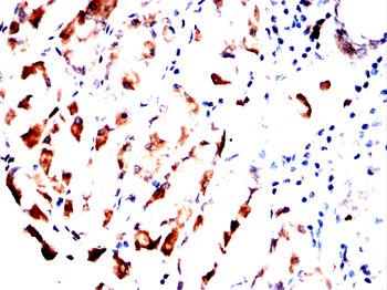 TFF2 Antibody