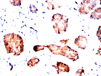 TFF2 Antibody