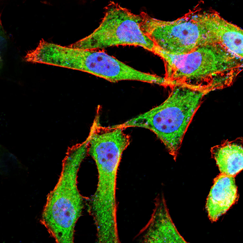 EPN1 Antibody