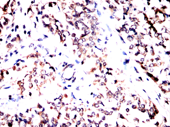 HDAC10 Antibody