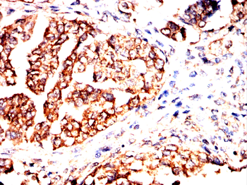 NME2 Antibody