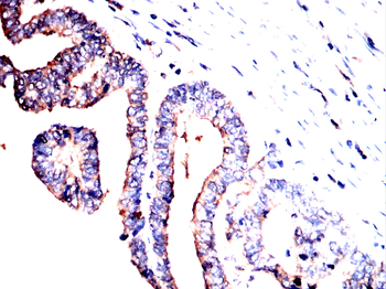 NME2 Antibody