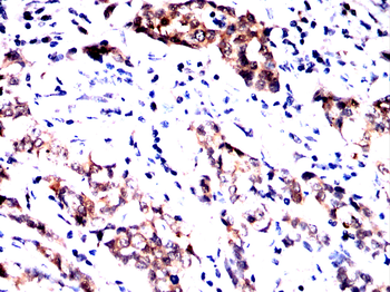 NME2 Antibody