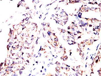 NME2 Antibody