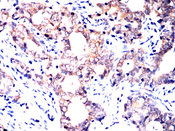 NME2 Antibody