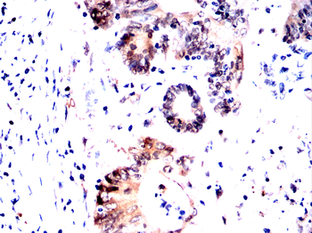 NME2 Antibody