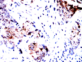 CDH17 Antibody