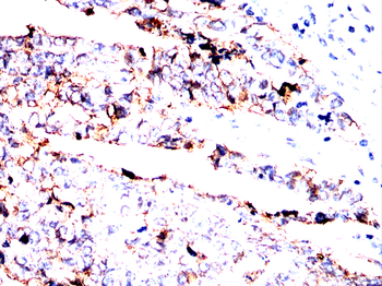 CDH17 Antibody