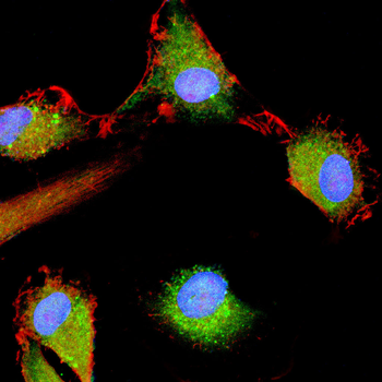 SSH1 Antibody
