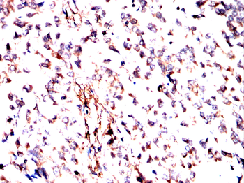 SSH1 Antibody
