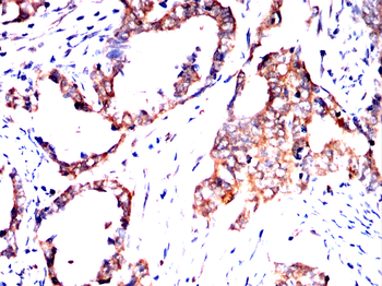 SSH1 Antibody
