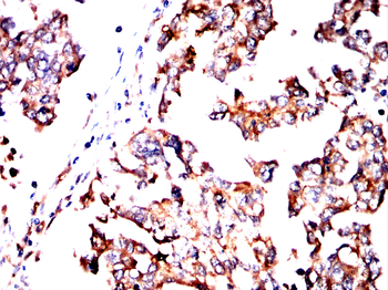 SSH1 Antibody