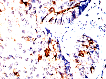 SSH1 Antibody