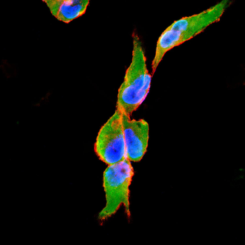 SSH1 Antibody