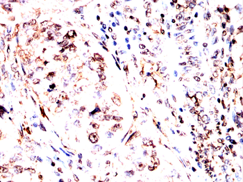 PDPK1 Antibody