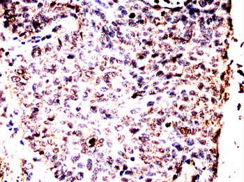 PDPK1 Antibody