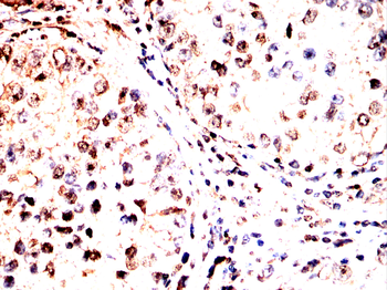 PDPK1 Antibody