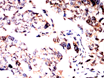 GAD2 Antibody