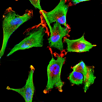TUBB Antibody