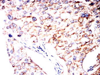 TUBB Antibody
