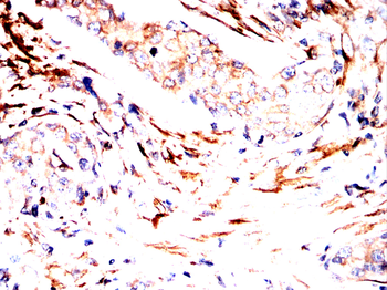 TUBB Antibody