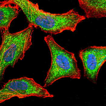 CSF1R Antibody