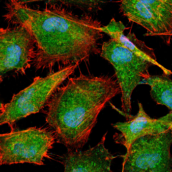HSPB2 Antibody