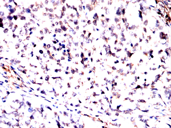 KDM5B Antibody