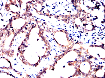 KDM5B Antibody