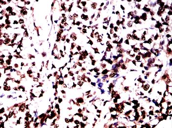 CBX1 Antibody
