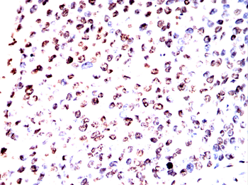 CBX1 Antibody