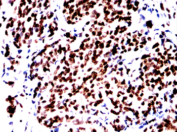 CBX1 Antibody