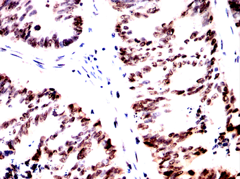 CBX1 Antibody