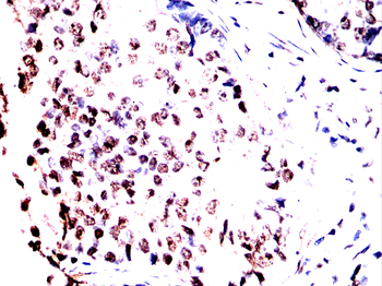 CBX1 Antibody