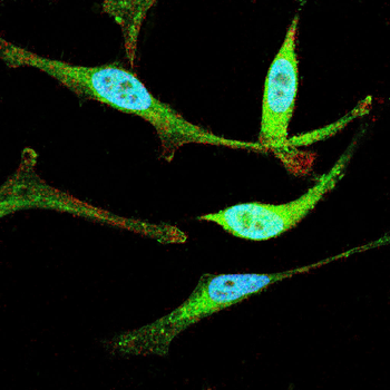 FN1 Antibody