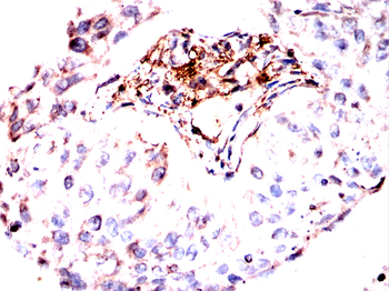FN1 Antibody
