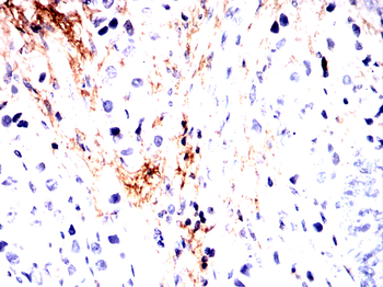 FN1 Antibody