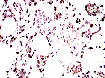 PARP1 Antibody