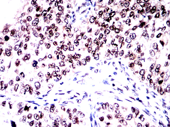 PARP1 Antibody