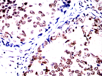 PARP1 Antibody