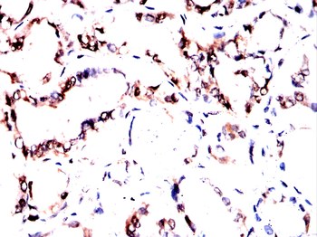 PARP1 Antibody