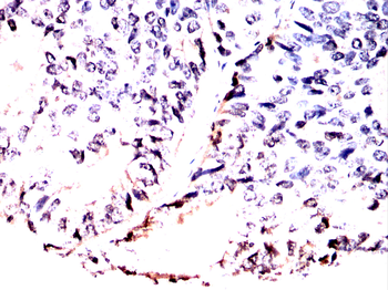 PARP1 Antibody