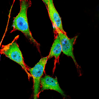 EPN1 Antibody